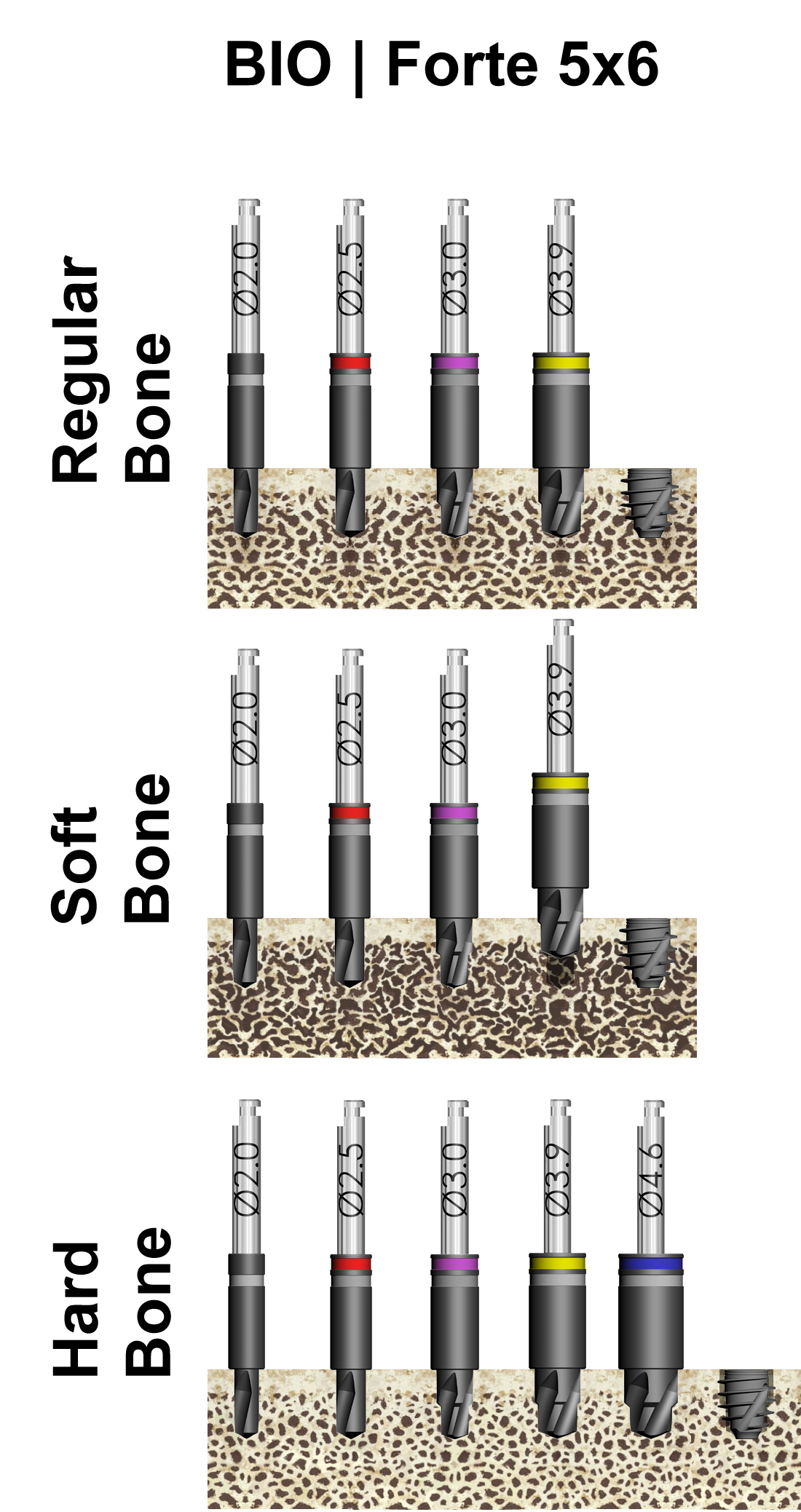 Drill Sequence BIO Forte 50 Blue Sky Bio